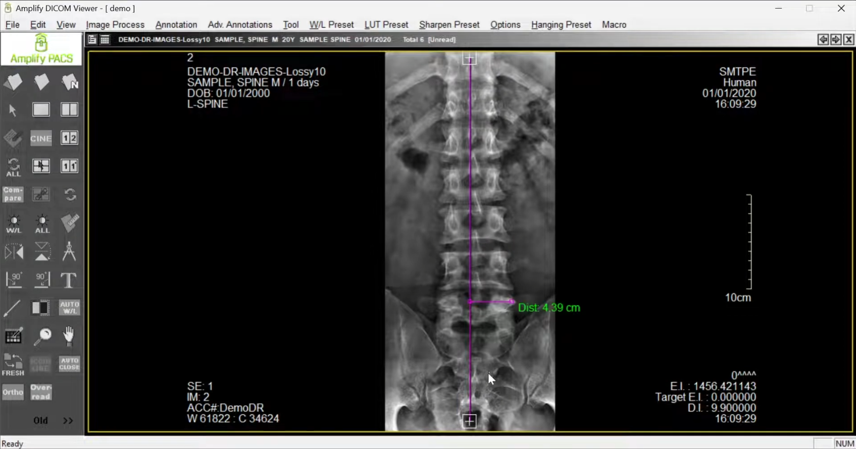 AmplifyPACS chiropractic X-ray measurement tools preview